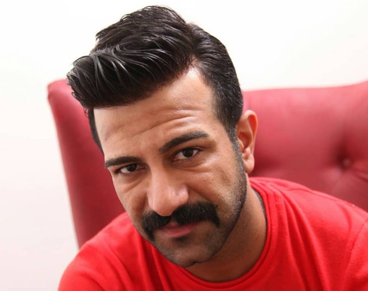 Protez saç uygulaması sonrası