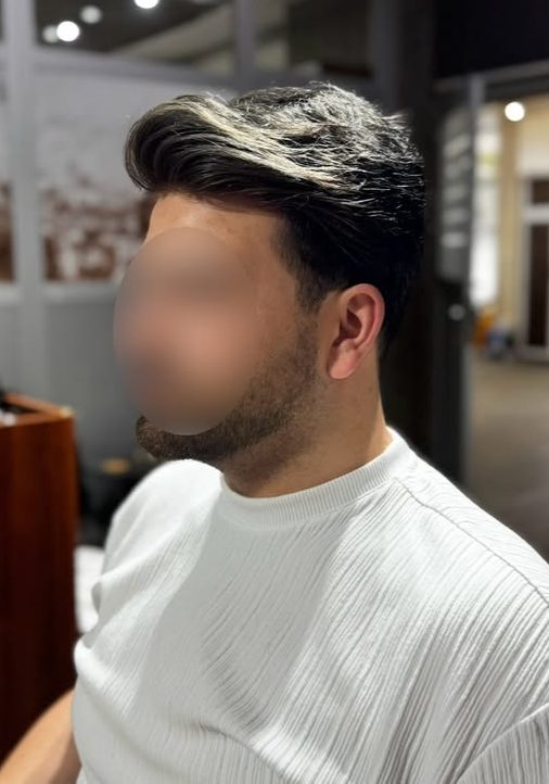 YS Hair'de protez saç uygulaması yapılmış, doğal görünümlü saç